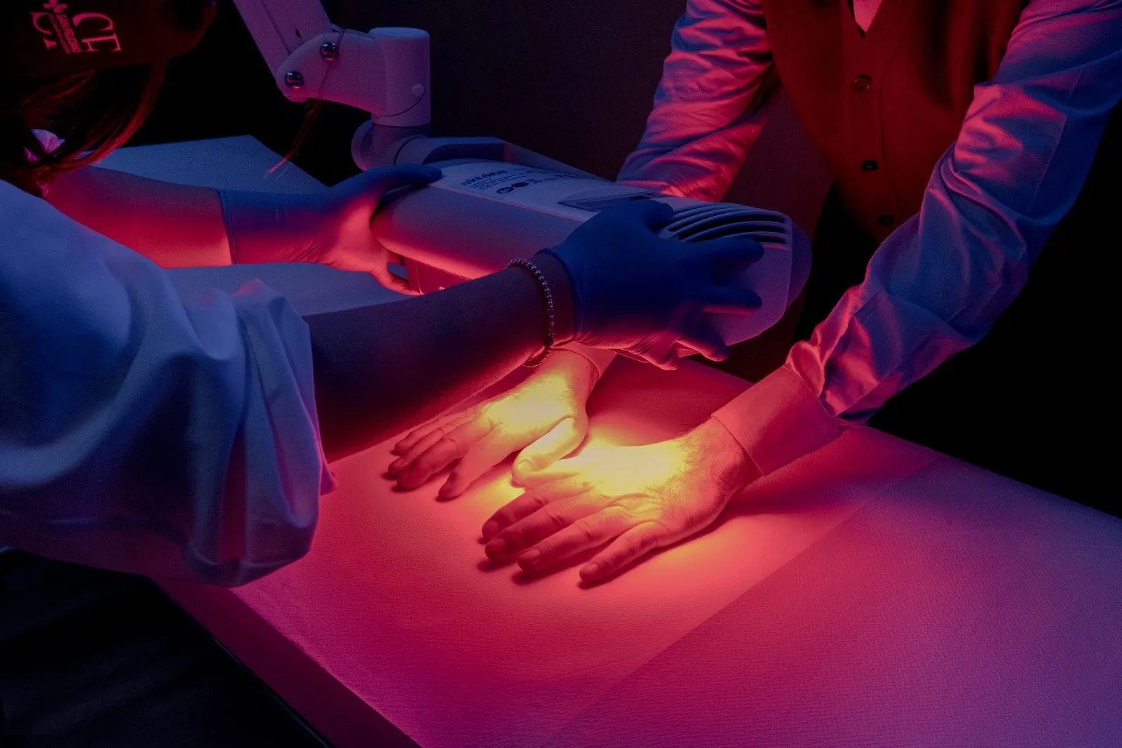 Scopri di più sull'articolo Terapia fotodinamica convenzionale nel trattamento delle cheratosi attiniche